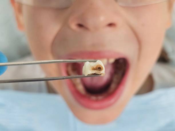 Fast & Reliable Emergency Dental Services in AL