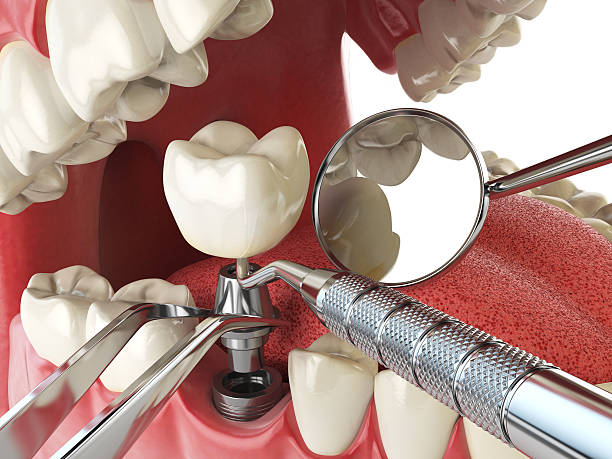 Best Walk-In Emergency Dentist in Cedar Bluff, AL